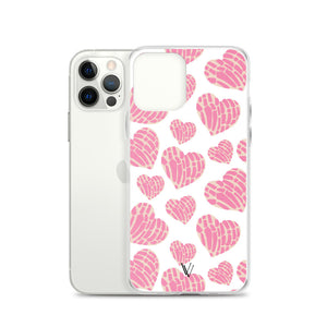 Concha IPhone Case